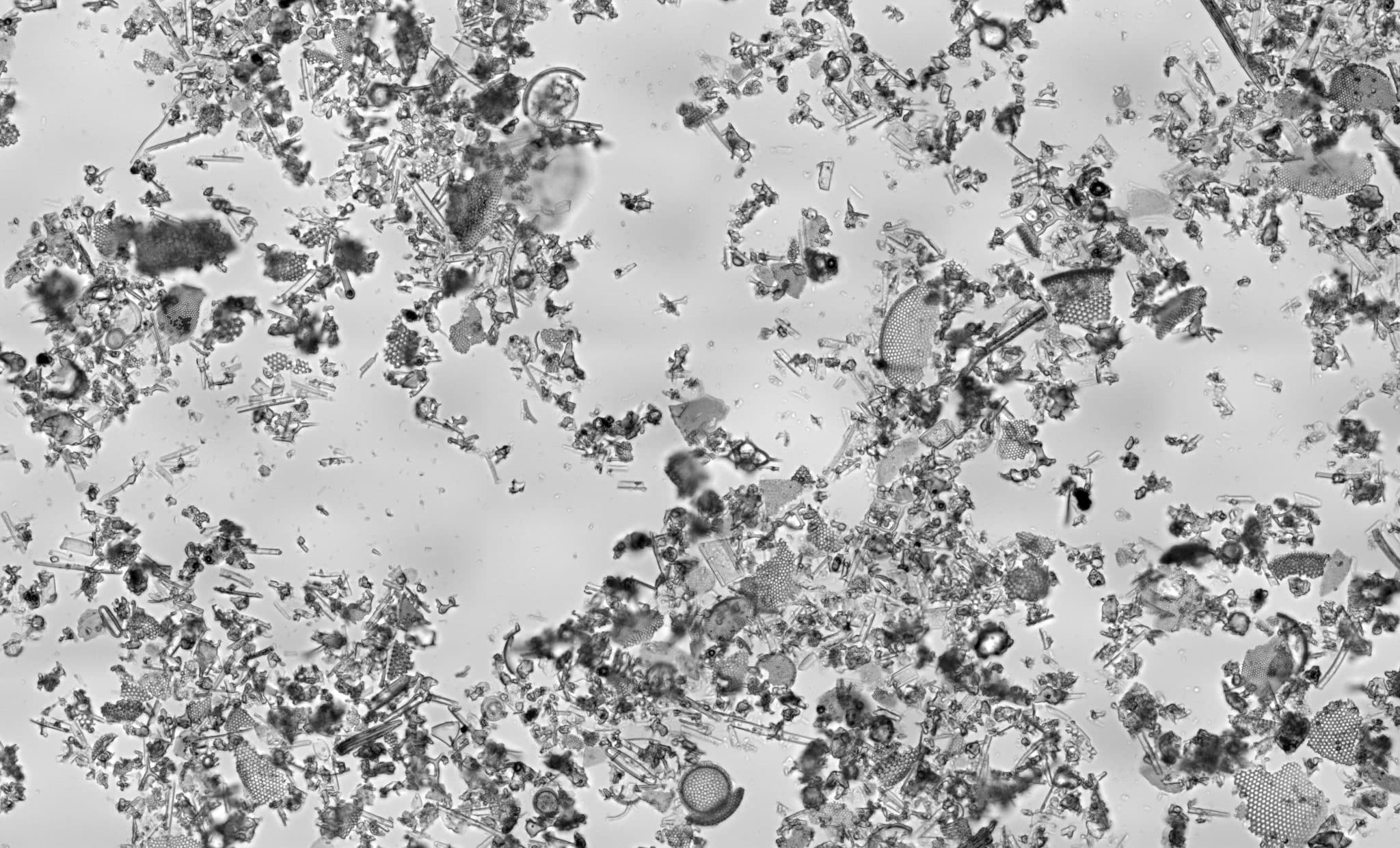 Microscope view of diatomaceous earth showing jagged, perforated diatom shell fragments among ground mineral particles
